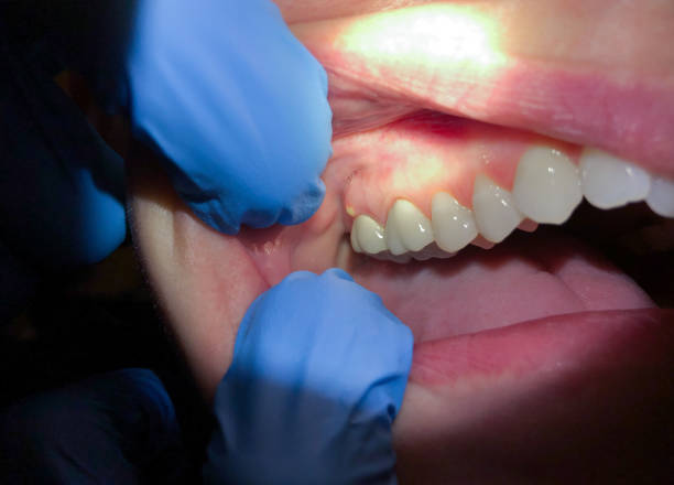 Best Mobile Emergency Dentist in Mcmurray, PA