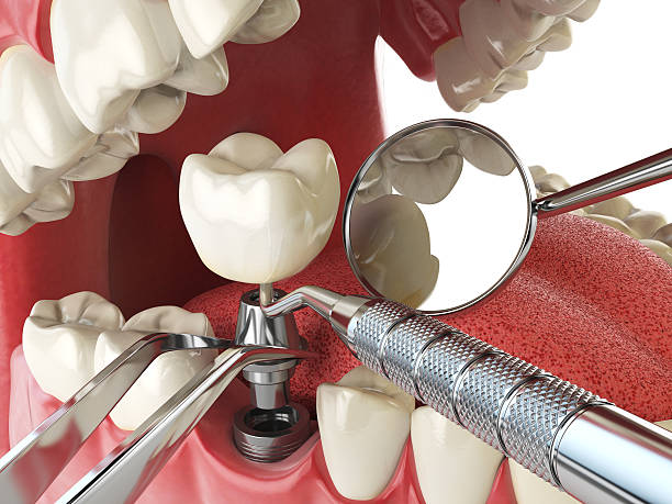 Best Emergency Dental Extractions in Mcmurray, PA